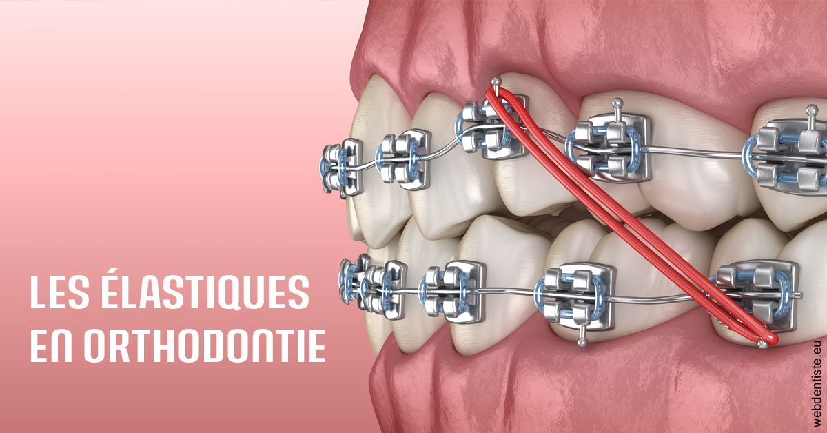 https://docteur-dabert-laurent-anne-gaelle.chirurgiens-dentistes.fr/Elastiques orthodontie 2